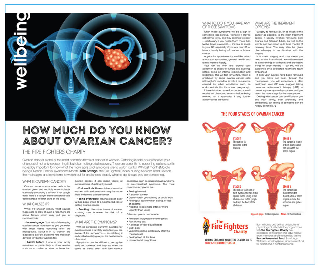 Ovarian cancer